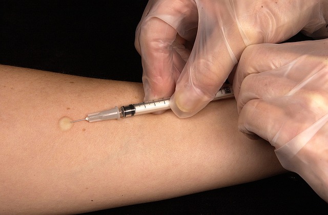 接种疫苗 结核菌素试验 注射 - 上的免费照片