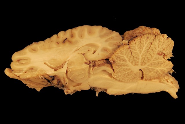 Gerhin 脑 马 - 上的免费照片