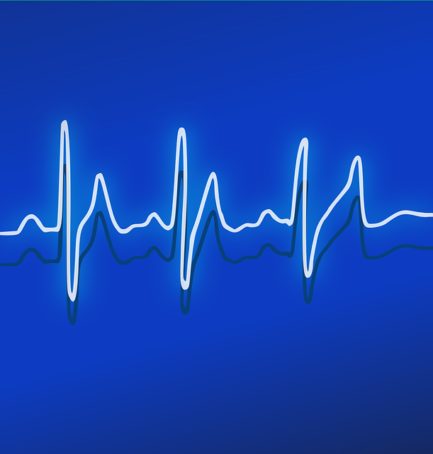 心电图 心跳 频率 - 免费矢量图形