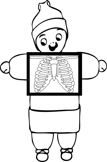 X射线 胸部 肋骨 - 免费矢量图形