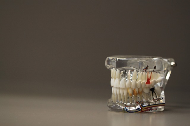 牙科 牙齿 模型 - 上的免费照片