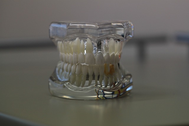 牙科 牙齿 模型 - 上的免费照片