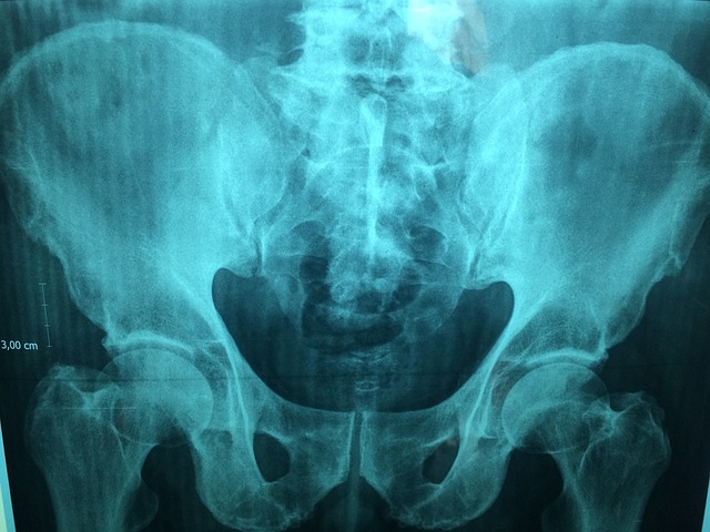 医生 X射线 医院 - 上的免费照片