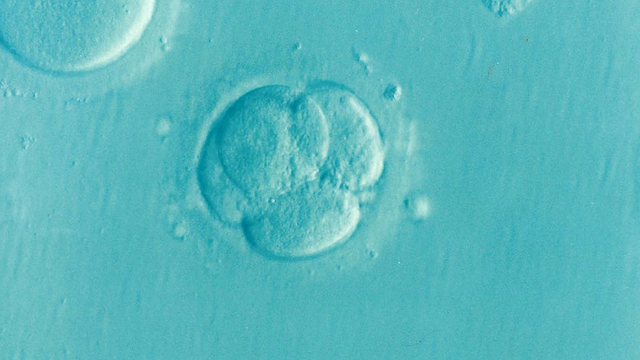 胚胎 试管婴儿 微施肥 - 上的免费照片