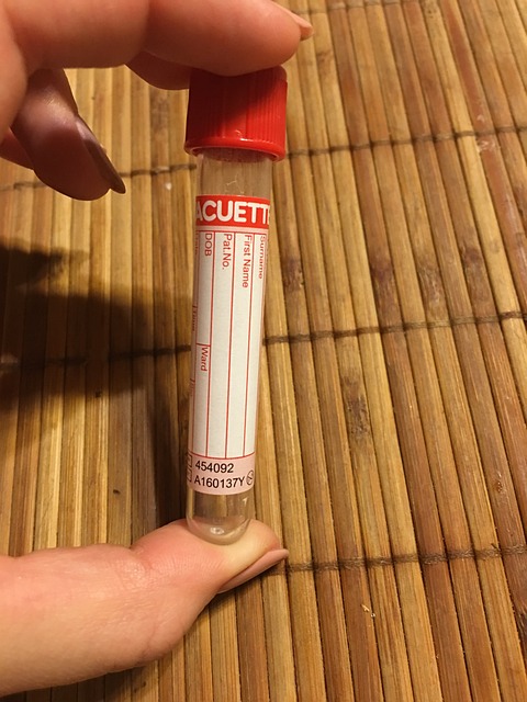 血 试管 下载 - 上的免费照片
