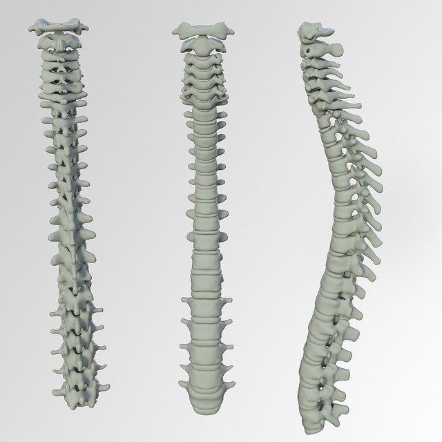 脊柱 骨 背疼 - 上的免费照片