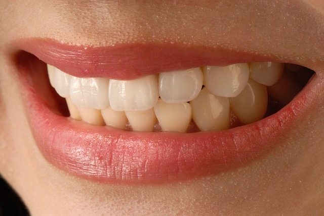 Asian Smile Anterior Teeth Veneer - 上的免费照片