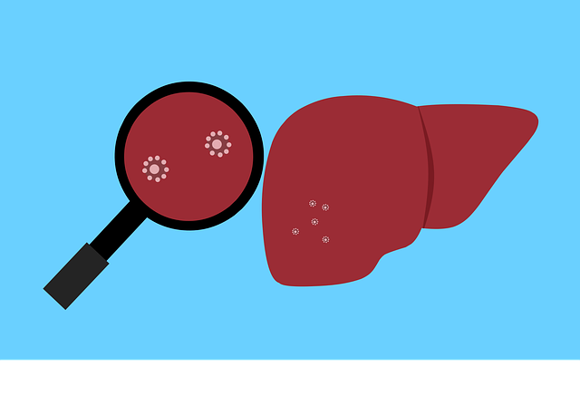 肝脏 细菌 病毒 - 免费矢量图形
