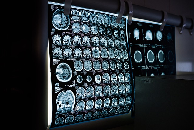 X 射线 磁共振成像 Ct 扫描 - 上的免费照片