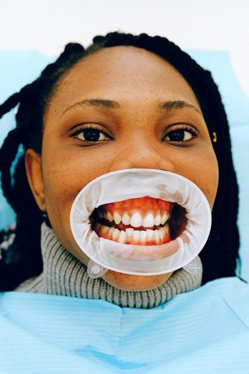 牙科诊所张大嘴巴的女性种族患者 · 免费素材图片