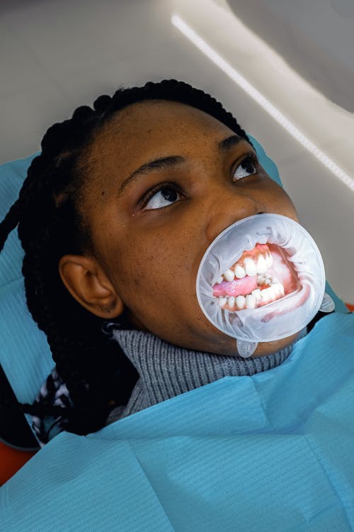 在诊所的牙科手术过程中，年轻女性种族患者与扩口器 · 免费素材图片