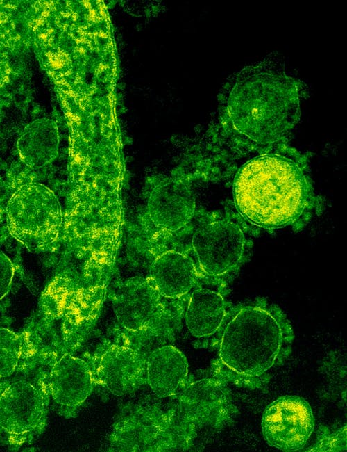 病毒的微观镜头 · 免费素材图片