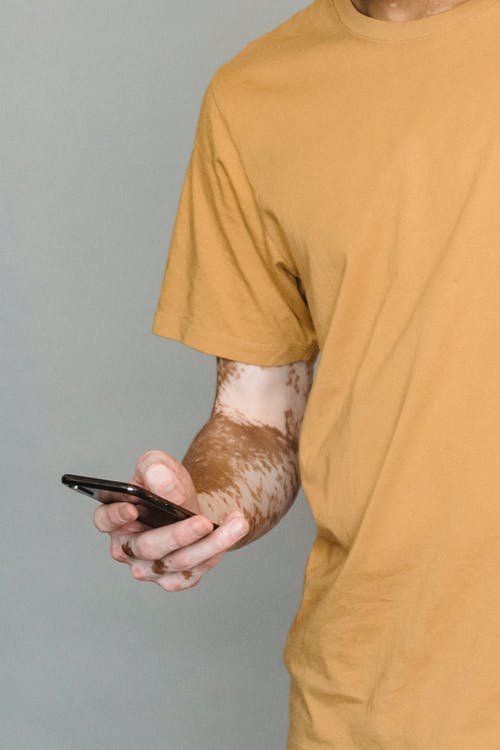 白癜风的人使用智能手机 · 免费素材图片