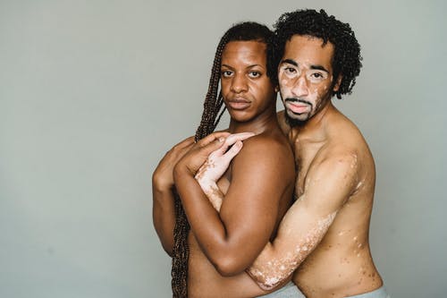 赤裸躯干拥抱的多种族变性人 · 免费素材图片