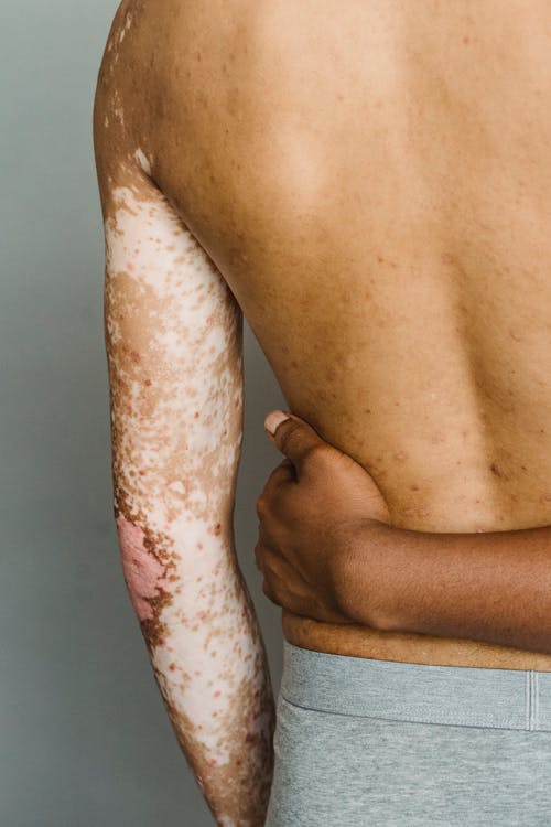 多样的夫妻在演播室互相拥抱 · 免费素材图片