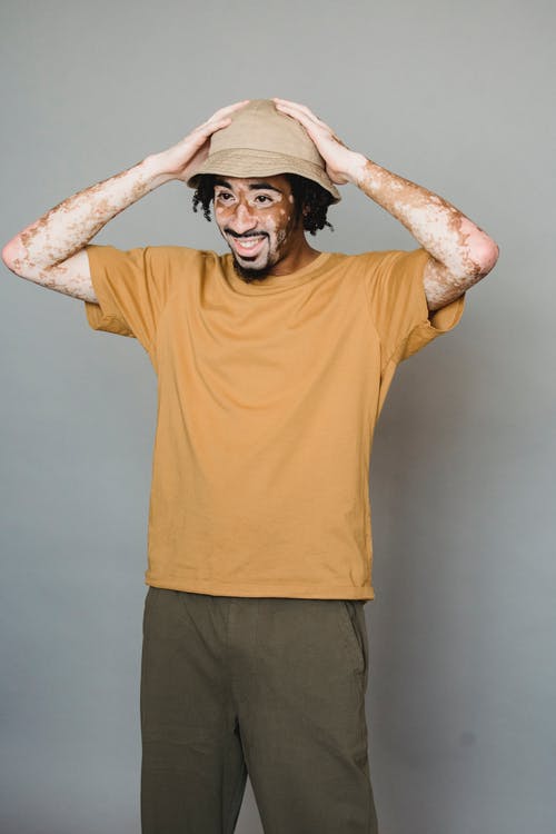 性格开朗的黑人与白癜风戴上帽子 · 免费素材图片