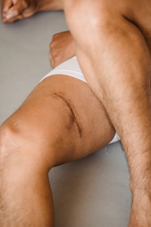 在内裤上有大腿上的疤痕的作物人 · 免费素材图片
