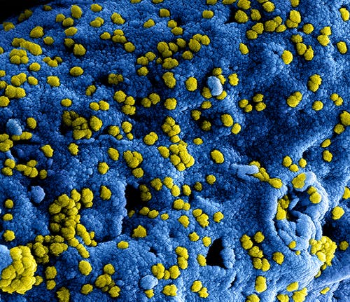 有关covid-19, 冠状病毒, 微生物学的免费素材图片