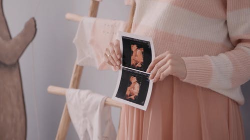 有关3d超声波, 女人, 室内的免费素材视频
