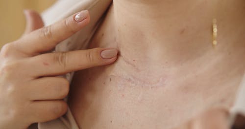 有关伤, 手指, 指甲的免费素材视频