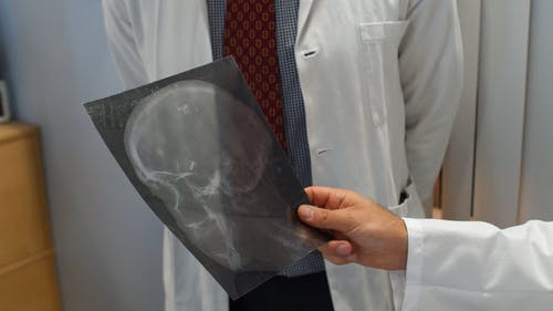 有关x射线, 不露面, 人的免费素材视频