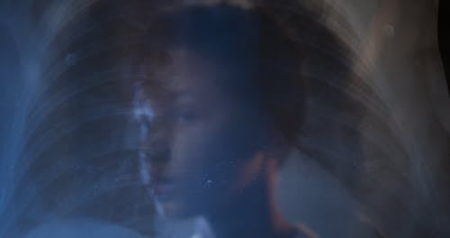 有关x射线, 儿童, 看着的免费素材视频