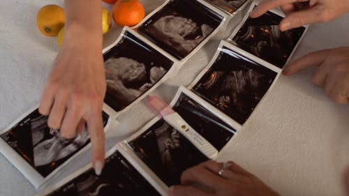 有关修剪指甲, 宝宝, 怀孕测试的免费素材视频
