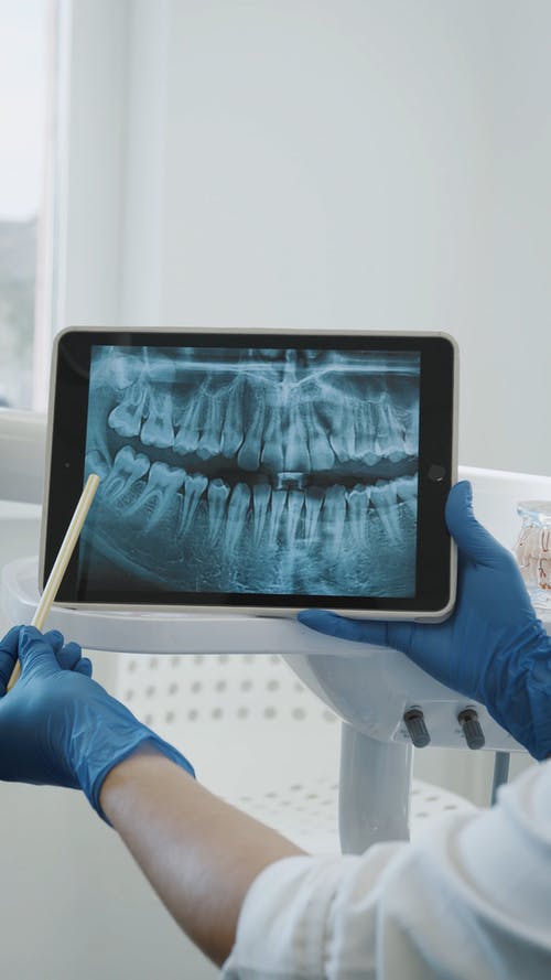 有关x射线图像, ライオ×歯医者, 医用手套的免费素材视频