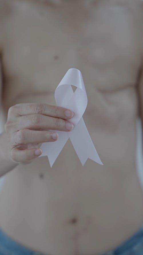 有关乳房切除术, 伤疤, 关注乳腺癌的免费素材视频