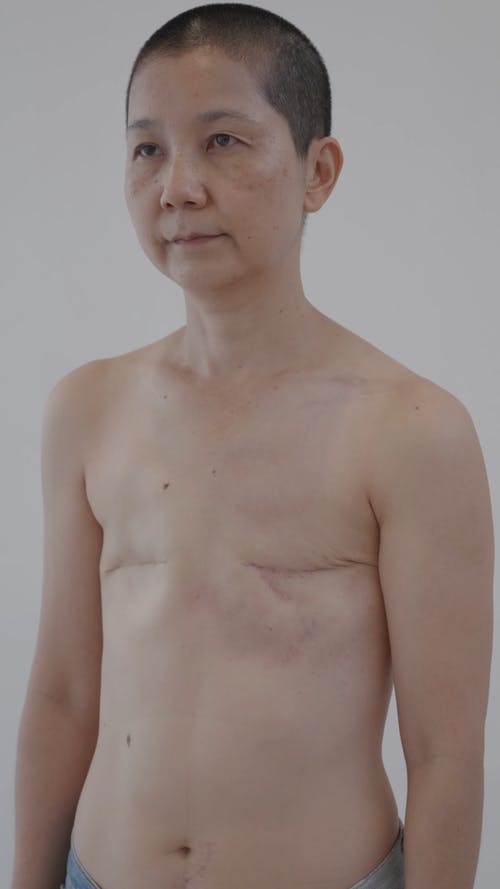 有关乳腺癌, 垂直视频, 女人的免费素材视频